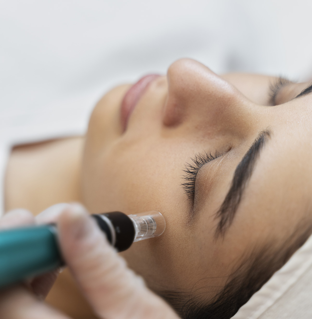 Medizinisches Microneedling in München Schwabing - Natürliche Hautverjüngung mit Dr. Sarah Bangert